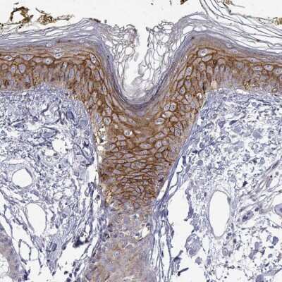 Immunohistochemistry-Paraffin: Ly-6D Antibody [NBP2-49416]