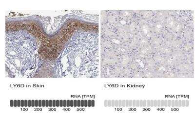 Immunohistochemistry-Paraffin: Ly-6D Antibody [NBP2-49416]