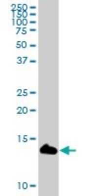 Western Blot: Ly-6D Antibody [H00008581-B02P]