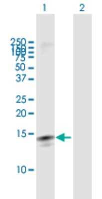 Western Blot: Ly-6D Antibody [H00008581-B02P]