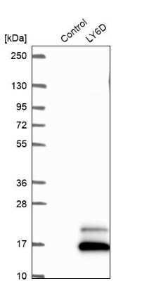 Western Blot: Ly-6D Antibody [NBP2-49416]