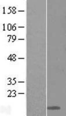 Western Blot: Ly-6D Overexpression Lysate [NBL1-12747]