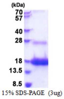 SDS-PAGE: Recombinant Human Ly-6D His Protein [NBP2-51531]