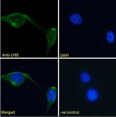 Immunocytochemistry/ Immunofluorescence: Ly-6E Antibody [NBP1-52176]
