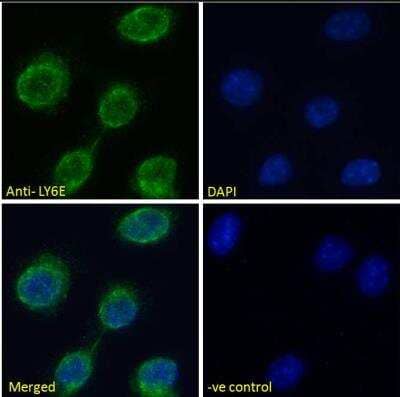 Immunocytochemistry/ Immunofluorescence: Ly-6E Antibody [NBP1-52176]