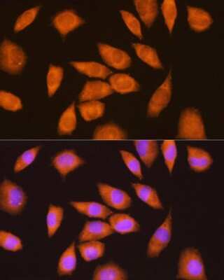 Immunocytochemistry/ Immunofluorescence: Ly-6E Antibody - BSA Free [NBP3-03570]