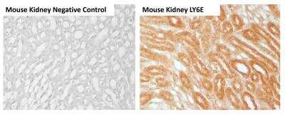 Immunohistochemistry-Paraffin: Ly-6E Antibody - BSA Free [NBP3-03570]