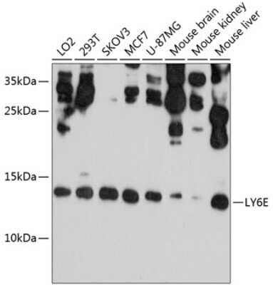 Western Blot: Ly-6E AntibodyBSA Free [NBP3-03570]