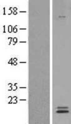 Western Blot: Ly-6E Overexpression Lysate [NBL1-12748]