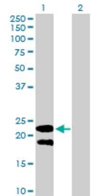 Western Blot: Ly-6G5B Antibody [H00058496-B01P]