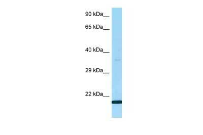 Western Blot: Ly-6G5B Antibody [NBP2-85072]