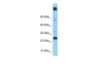 Western Blot: Ly-6G5C Antibody [NBP2-83166]