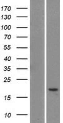 Western Blot: Ly-6G5C Overexpression Lysate [NBP2-06221]