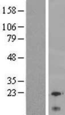 Western Blot: Ly-6G6C Overexpression Lysate [NBP2-06220]