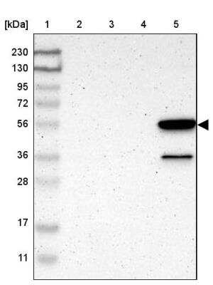 Western Blot: Ly-6G6F Antibody [NBP1-86749]