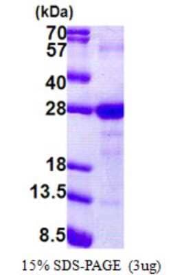 SDS-PAGE: Recombinant Human Ly-6G6F His Protein [NBP2-23204]