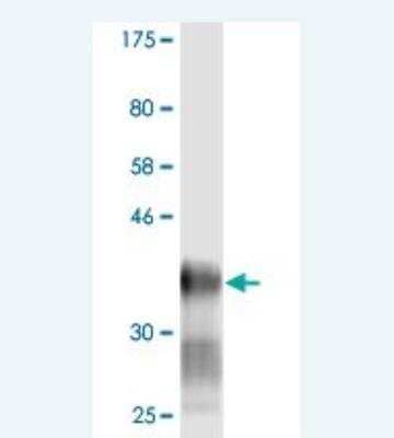 Western Blot: Ly-6H Antibody (1D1) [H00004062-M02]