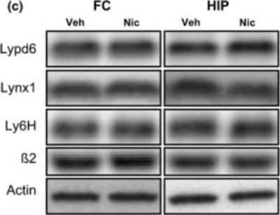 Western Blot: Ly-6H Antibody (3E10) [H00004062-M01]