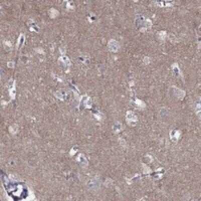 Immunohistochemistry-Paraffin: Ly-6H Antibody [NBP3-17515]