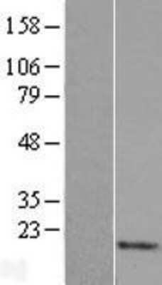 Western Blot: Ly-6H Overexpression Lysate [NBL1-12749]