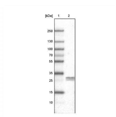 Western Blot: Ly6K Antibody (CL2433) [NBP2-36763]