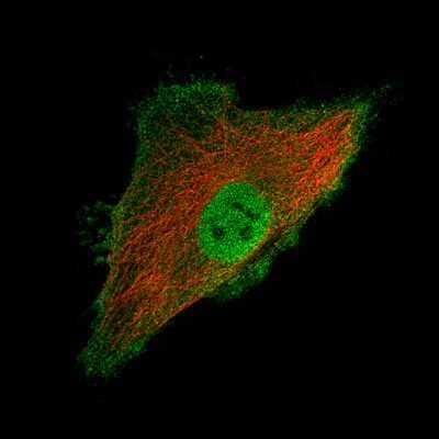 Immunocytochemistry/ Immunofluorescence: Ly6K Antibody (CL2435) [NBP2-36764]