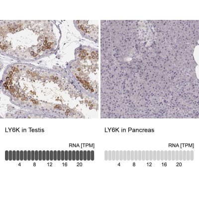 Immunohistochemistry-Paraffin: Ly6K Antibody [NBP1-84340]