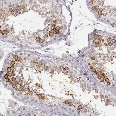 Immunohistochemistry-Paraffin: Ly6K Antibody [NBP1-84340]