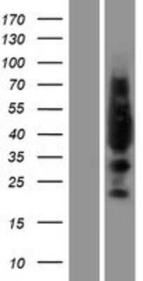 Western Blot: Lyl1 Overexpression Lysate [NBP2-07729]