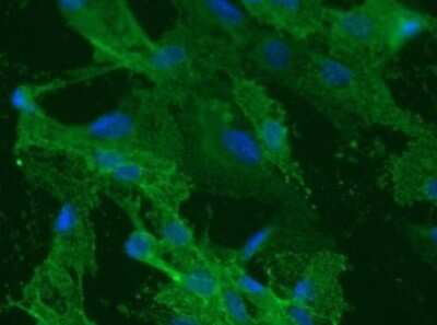Immunocytochemistry/ Immunofluorescence: Lymphatic Endothelial Cells Antibody (LA102) - Azide and BSA Free [NB110-96416]