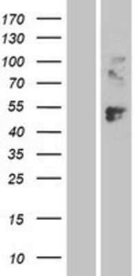 Western Blot: LAG-3 Overexpression Lysate [NBP2-04223]