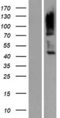 Western Blot: CD229/SLAMF3/Lymphocyte Antigen 9 Overexpression Lysate [NBP2-10823]