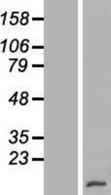 Western Blot: XCL1/Lymphotactin Overexpression Lysate [NBL1-17901]