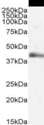 Western Blot: Lymphotoxin-alpha/TNF-beta Antibody (3F12.2D3)ChimericAzide and BSA Free [NBP2-81105]