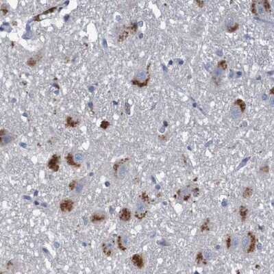 Immunohistochemistry-Paraffin: Lymphotoxin-alpha/TNF-beta Antibody [NBP1-87725]