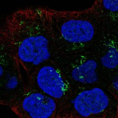 Immunocytochemistry/ Immunofluorescence: Lymphotoxin beta R/TNFRSF3 Antibody [NBP2-68777]