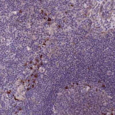 Immunohistochemistry-Paraffin: Lymphotoxin beta/TNFSF3 Antibody [NBP2-14207]