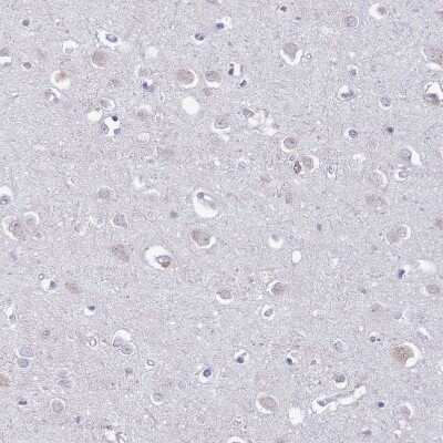 Immunohistochemistry-Paraffin: Lymphotoxin beta/TNFSF3 Antibody [NBP2-14207]