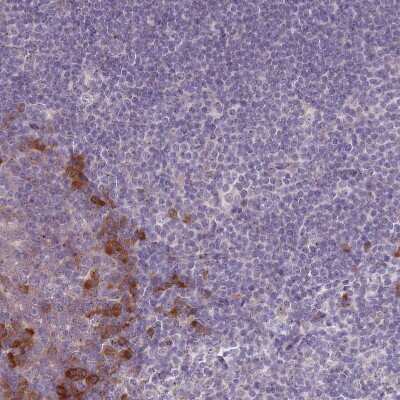 Immunohistochemistry-Paraffin: Lymphotoxin beta/TNFSF3 Antibody [NBP2-14207]