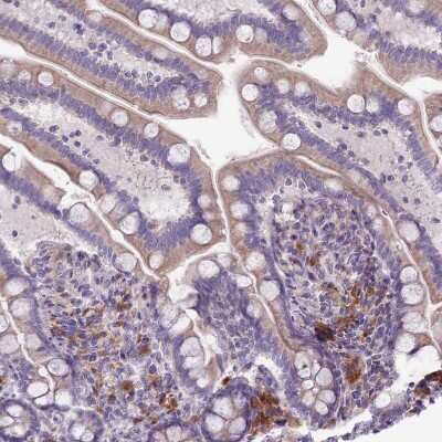 Immunohistochemistry-Paraffin: Lymphotoxin beta/TNFSF3 Antibody [NBP2-14207]
