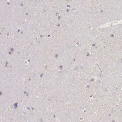 Immunohistochemistry-Paraffin: Lyn Antibody [NBP1-83072]
