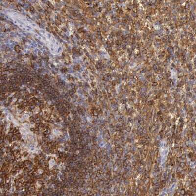 Immunohistochemistry-Paraffin: Lyn Antibody [NBP1-83072]