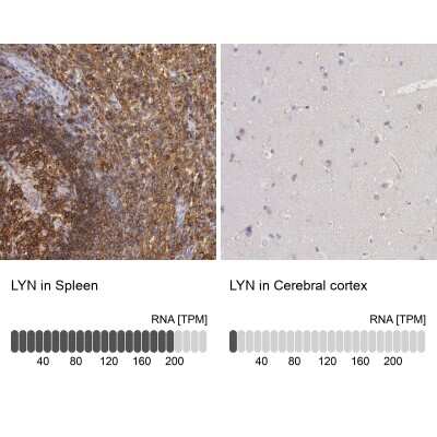 Immunohistochemistry-Paraffin: Lyn Antibody [NBP1-83072]