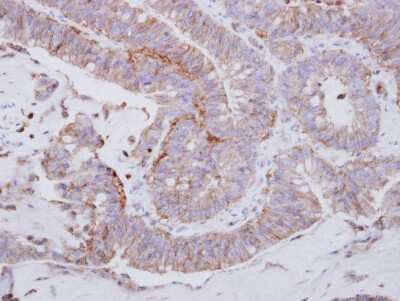 Immunohistochemistry-Paraffin: Lyn Antibody [NBP2-17188]