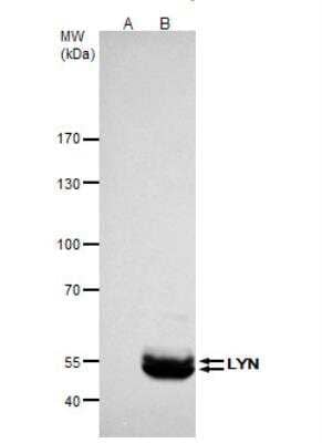 Immunoprecipitation: Lyn Antibody [NBP2-17188]