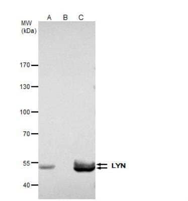 Immunoprecipitation: Lyn Antibody [NBP2-17189]