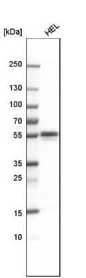 Western Blot: Lyn Antibody [NBP1-83072]