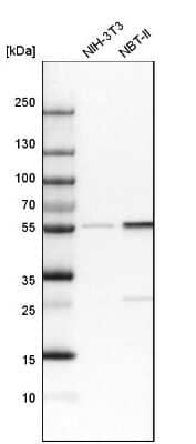 Western Blot: Lyn Antibody [NBP1-83072]