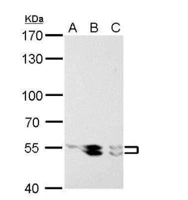 Western Blot: Lyn Antibody [NBP2-17188]