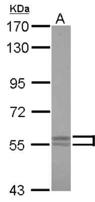 Western Blot: Lyn Antibody [NBP2-17189]